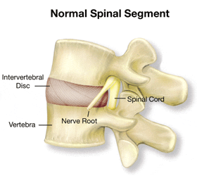 Illustration of a Normal Spinal Segment With Labels for the Intervertebral Disc, Spinal Cord, Nerve Root, and Vertebra