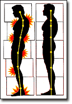 Illustration of Two Silhouettes of People With Lines and Orange Bursts Indicating Pain Points on Their Bodies